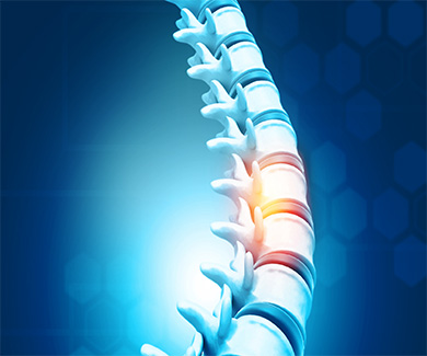 Card: Diagnosis and Treatment of Tethered Spinal Cord