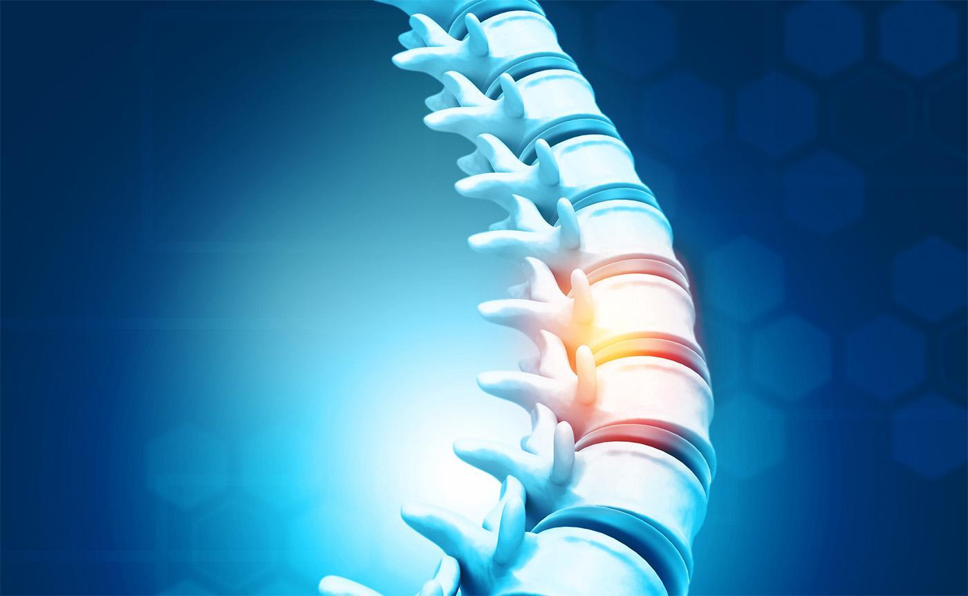 Diagnosis and Treatment of Tethered Spinal Cord